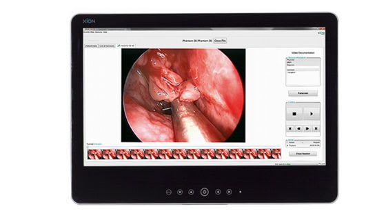 Head of Endoscopy